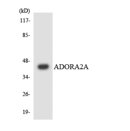 Western Blot - Anti-ADORA2A Antibody (R12-2452) - Antibodies.com