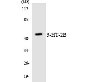Western Blot - Anti-5-HT-2B Antibody (R12-2420) - Antibodies.com