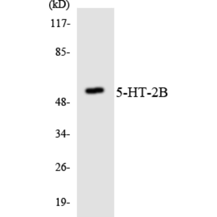 Western Blot - Anti-5-HT-2B Antibody (R12-2420) - Antibodies.com