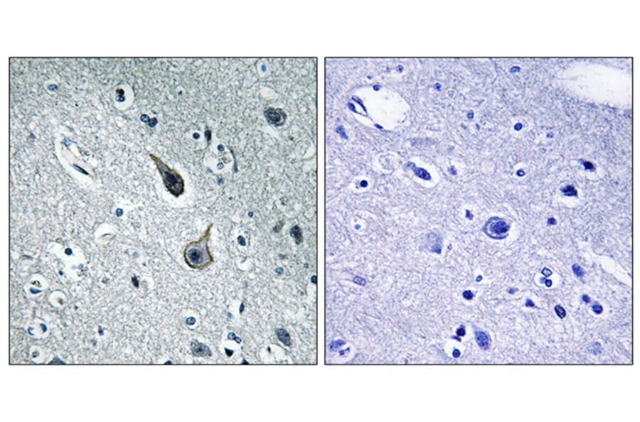 Immunohistochemistry - Anti-5-HT-2A Antibody (C12013) - Antibodies.com