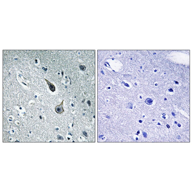 Immunohistochemistry - Anti-5-HT-2A Antibody (C12013) - Antibodies.com