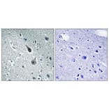 Immunohistochemistry - Anti-5-HT-2A Antibody (C12013) - Antibodies.com