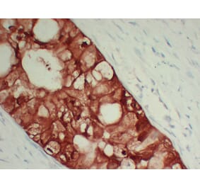 Immunohistochemistry - Anti-S100A6 Antibody (V0146) - Antibodies.com