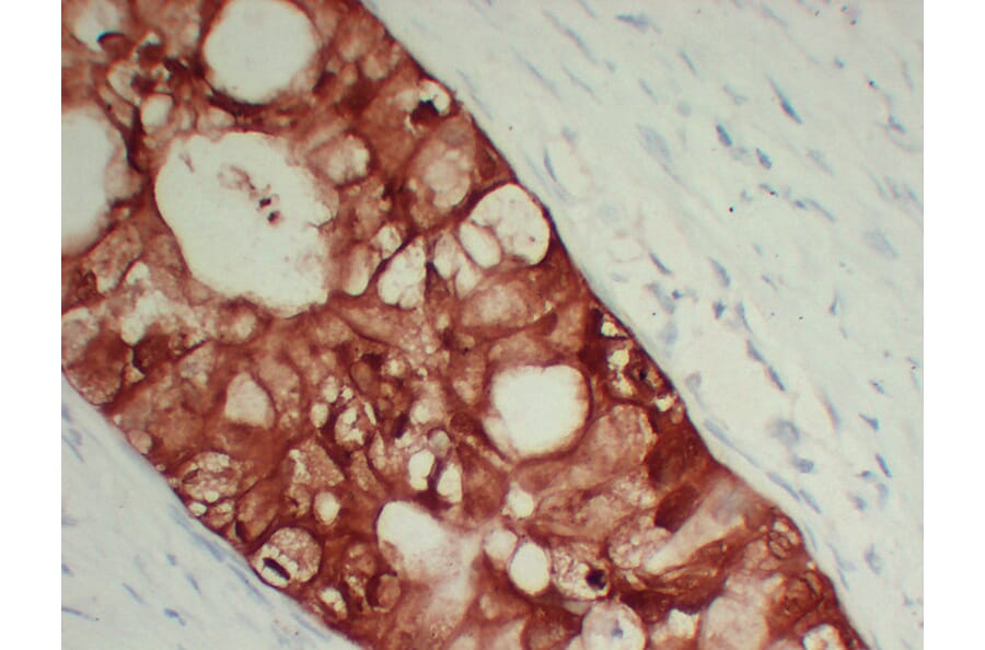 Immunohistochemistry - Anti-S100A6 Antibody (V0146) - Antibodies.com