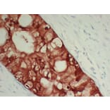 Immunohistochemistry - Anti-S100A6 Antibody (V0146) - Antibodies.com