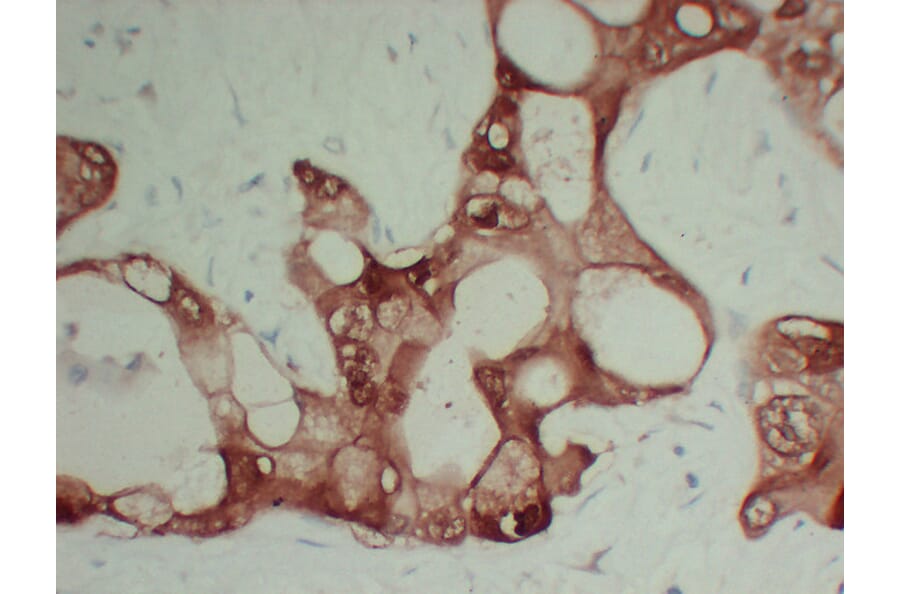 Immunohistochemistry - Anti-S100A6 Antibody (V0146) - Antibodies.com