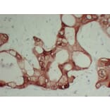 Immunohistochemistry - Anti-S100A6 Antibody (V0146) - Antibodies.com