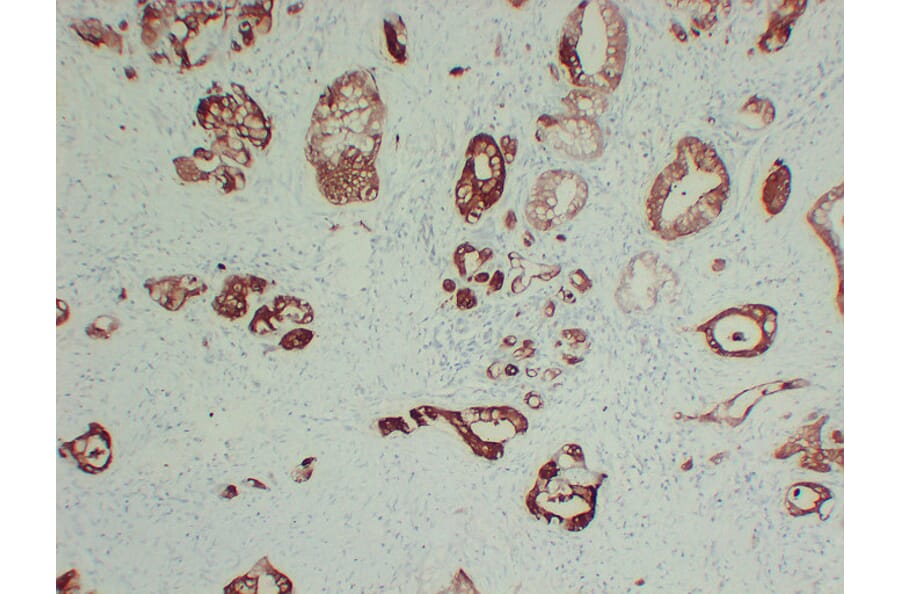 Immunohistochemistry - Anti-S100A6 Antibody (V0146) - Antibodies.com
