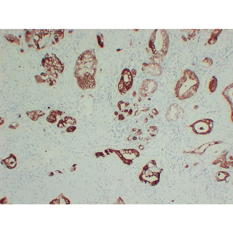 Immunohistochemistry - Anti-S100A6 Antibody (V0146) - Antibodies.com