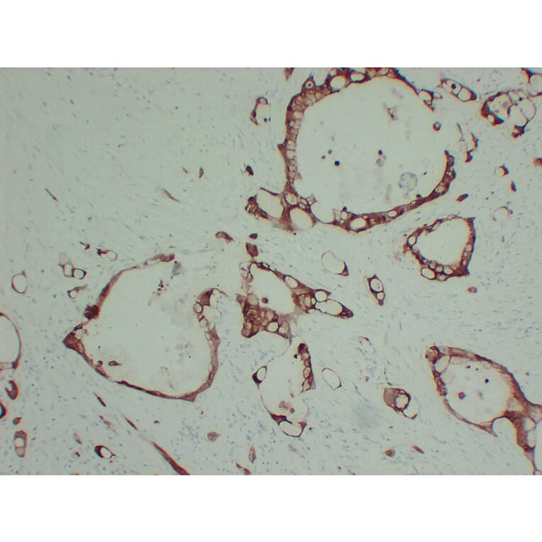 Immunohistochemistry - Anti-S100A6 Antibody (V0146) - Antibodies.com