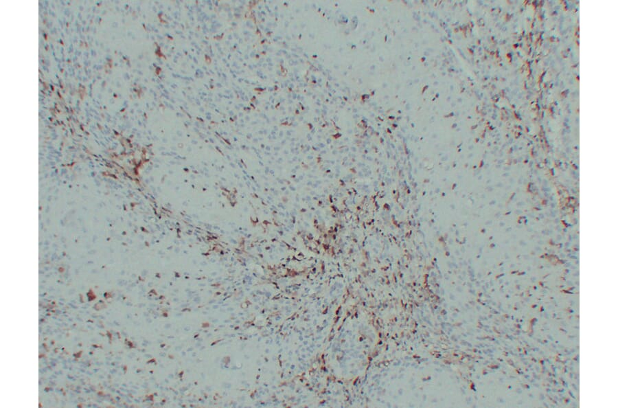 Immunohistochemistry - Anti-S100A4 Antibody (V0122) - Antibodies.com