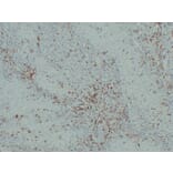 Immunohistochemistry - Anti-S100A4 Antibody (V0122) - Antibodies.com