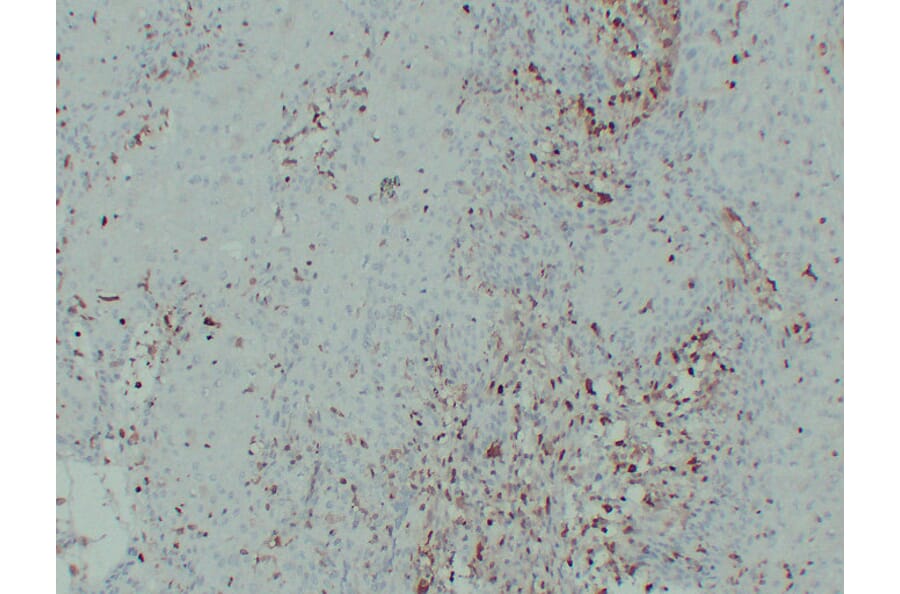 Immunohistochemistry - Anti-S100A4 Antibody (V0122) - Antibodies.com