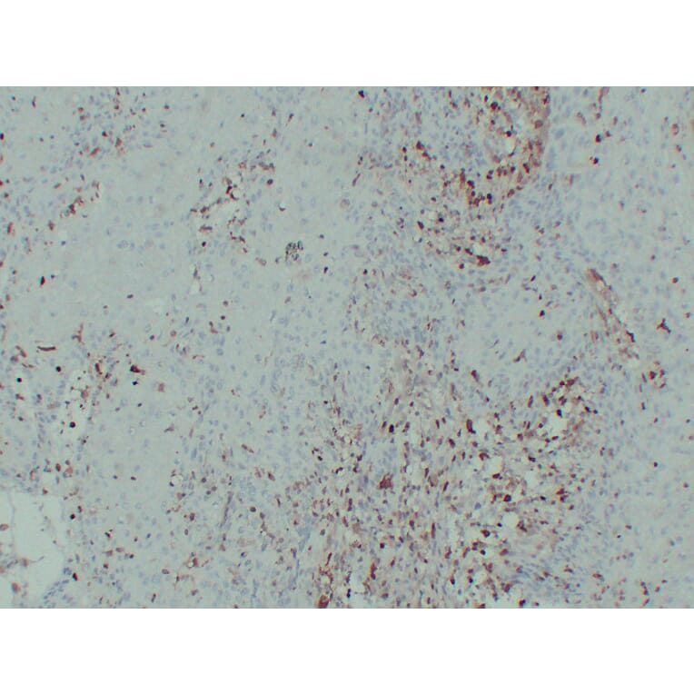 Immunohistochemistry - Anti-S100A4 Antibody (V0122) - Antibodies.com