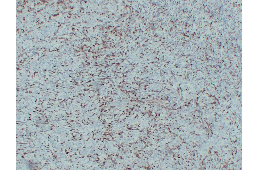 Immunohistochemistry - Anti-S100A4 Antibody (V0122) - Antibodies.com