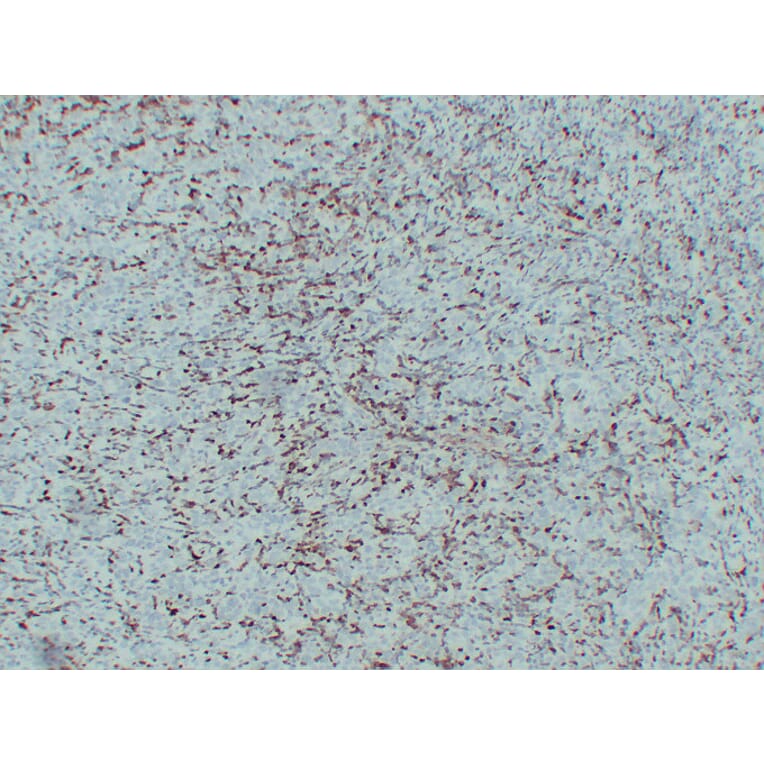 Immunohistochemistry - Anti-S100A4 Antibody (V0122) - Antibodies.com