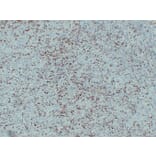 Immunohistochemistry - Anti-S100A4 Antibody (V0122) - Antibodies.com