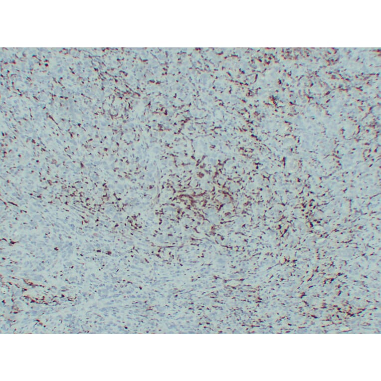 Immunohistochemistry - Anti-S100A4 Antibody (V0122) - Antibodies.com