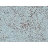 Immunohistochemistry - Anti-S100A4 Antibody (V0122) - Antibodies.com