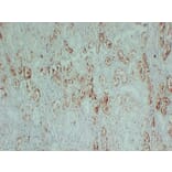 Immunohistochemistry - Anti-S100A1 Antibody (V0121) - Antibodies.com