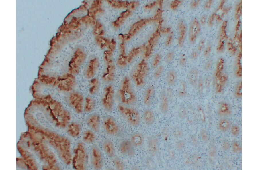 Immunohistochemistry - Anti-MUC5AC Antibody (V0097) - Antibodies.com