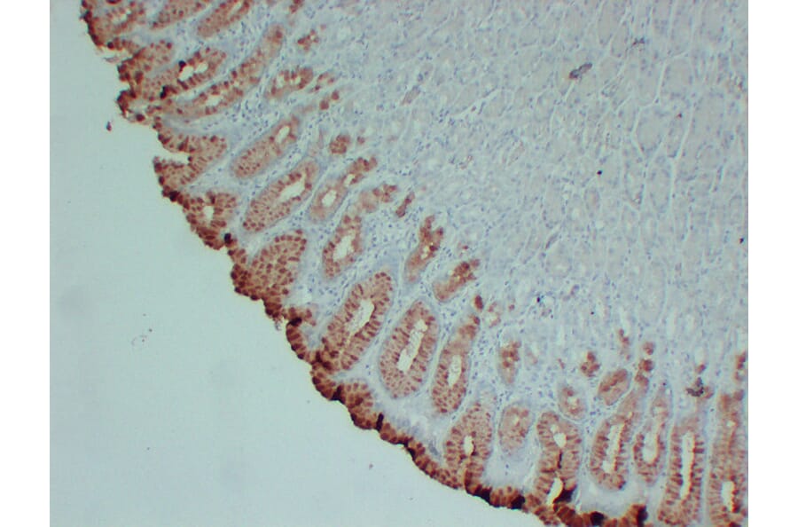 Immunohistochemistry - Anti-MUC5AC Antibody (V0097) - Antibodies.com