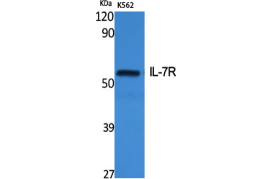 Western Blot - Anti-IL-7R Antibody (B1065) - Antibodies.com