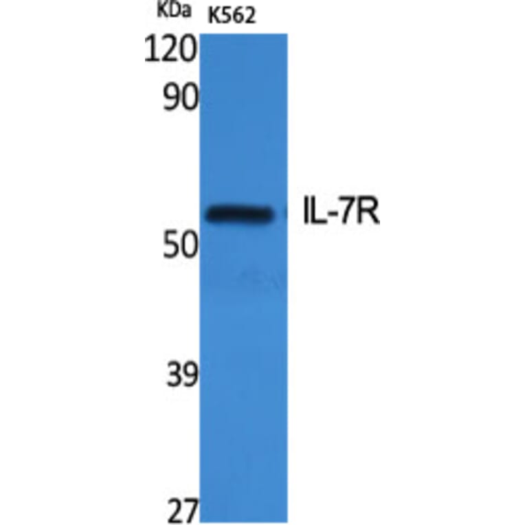 Western Blot - Anti-IL-7R Antibody (B1065) - Antibodies.com