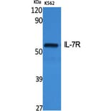 Western Blot - Anti-IL-7R Antibody (B1065) - Antibodies.com