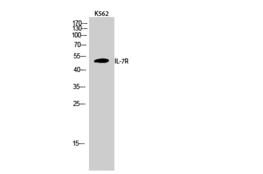 Western Blot - Anti-IL-7R Antibody (B1065) - Antibodies.com