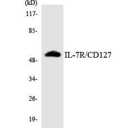 Western Blot - Anti-IL-7R Antibody (R12-2924) - Antibodies.com