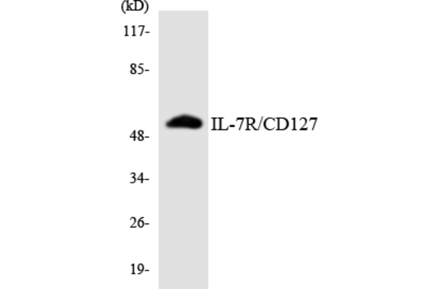 Western Blot - Anti-IL-7R Antibody (R12-2924) - Antibodies.com