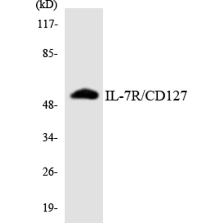 Western Blot - Anti-IL-7R Antibody (R12-2924) - Antibodies.com