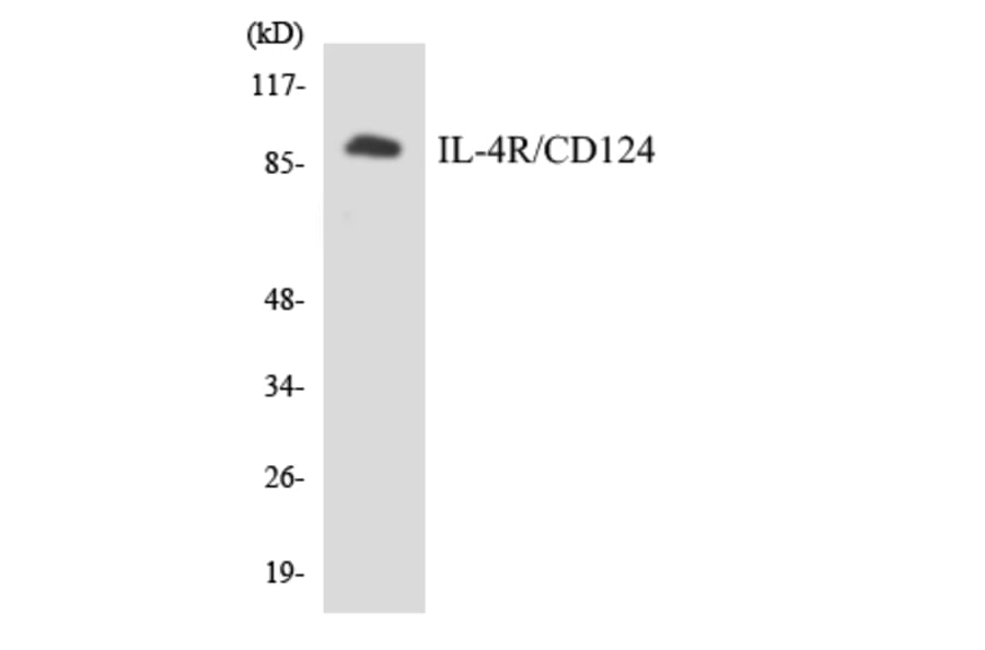 Western Blot - Anti-IL-4R Antibody (R12-2923) - Antibodies.com
