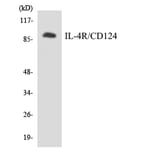 Western Blot - Anti-IL-4R Antibody (R12-2923) - Antibodies.com
