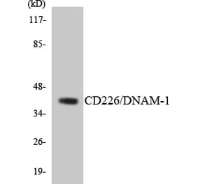 Western Blot - Anti-CD226 Antibody (R12-2587) - Antibodies.com