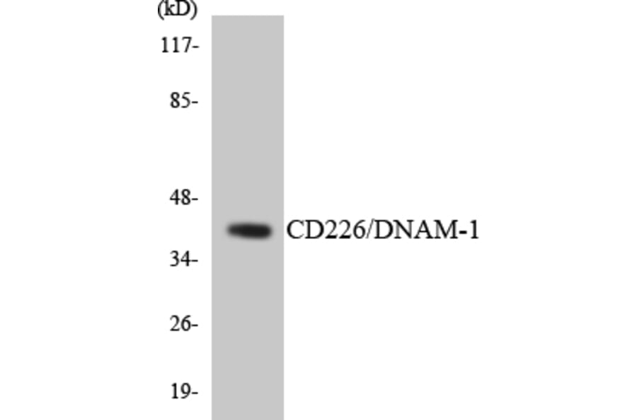 Western Blot - Anti-CD226 Antibody (R12-2587) - Antibodies.com
