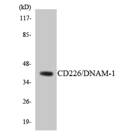 Western Blot - Anti-CD226 Antibody (R12-2587) - Antibodies.com