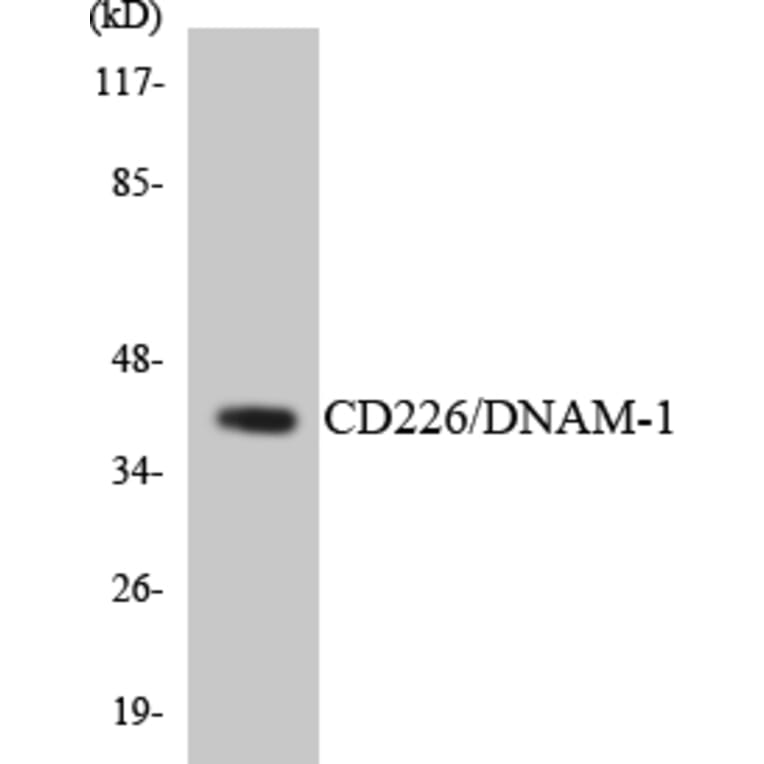 Western Blot - Anti-CD226 Antibody (R12-2587) - Antibodies.com