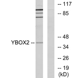 Western Blot - Anti-YBOX2 Antibody (C11938) - Antibodies.com