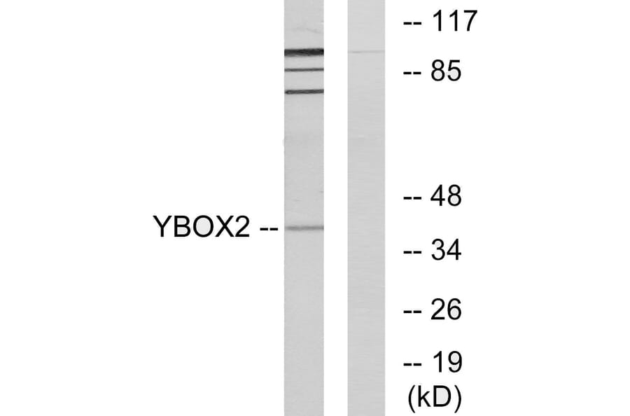 Western Blot - Anti-YBOX2 Antibody (C11938) - Antibodies.com