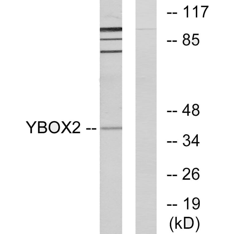 Western Blot - Anti-YBOX2 Antibody (C11938) - Antibodies.com