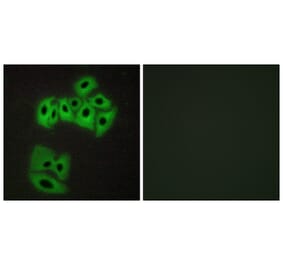 Immunofluorescence - Anti-VAMP4 Antibody (B1240) - Antibodies.com