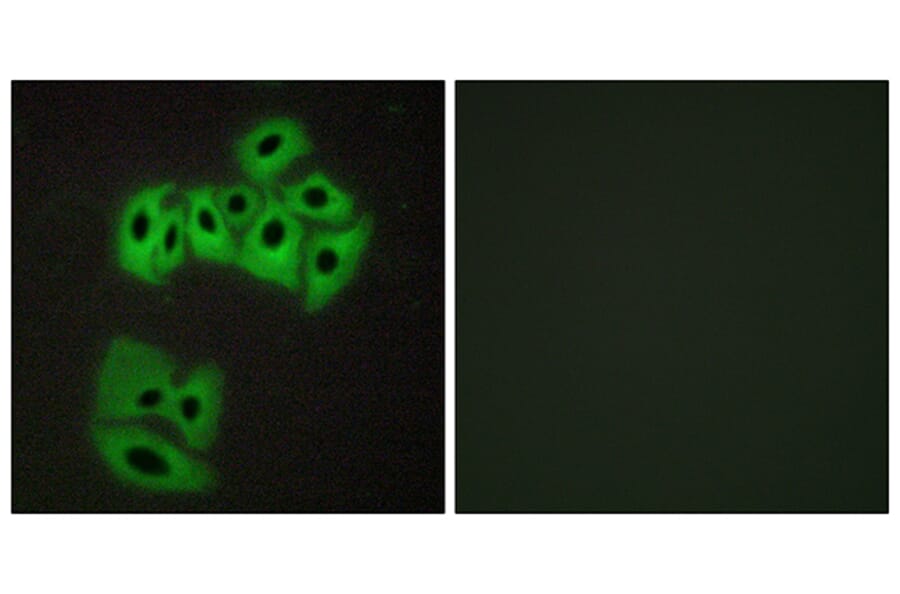 Immunofluorescence - Anti-VAMP4 Antibody (B1240) - Antibodies.com