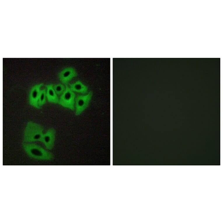 Immunofluorescence - Anti-VAMP4 Antibody (B1240) - Antibodies.com