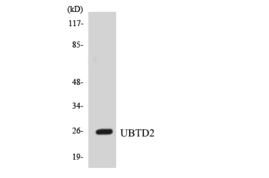 Western Blot - Anti-UBTD2 Antibody (R12-3666) - Antibodies.com