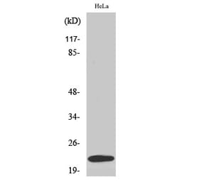 Western Blot - Anti-UBE2T Antibody (C19447) - Antibodies.com