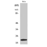 Western Blot - Anti-UBE2T Antibody (C19447) - Antibodies.com