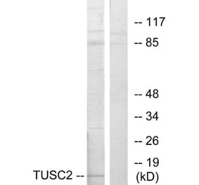 Western Blot - Anti-TUSC2 Antibody (C10196) - Antibodies.com