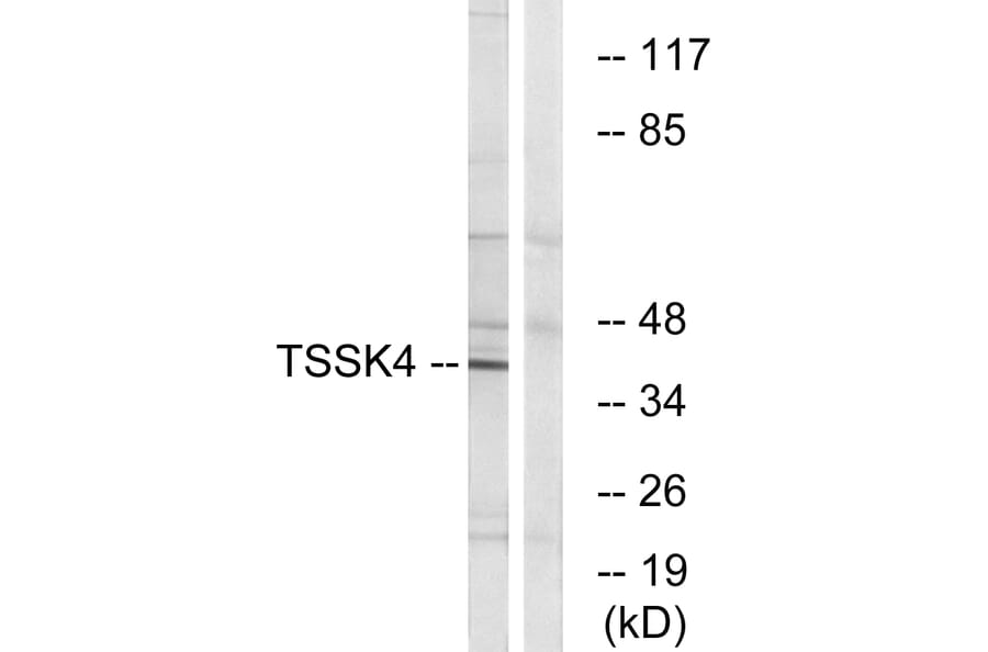 Western Blot - Anti-TSSK4 Antibody (C19097) - Antibodies.com
